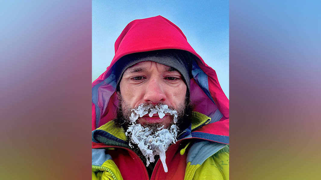 James McCorkindale's beard becoming frozen as he crosses the Arctic for Nacoa